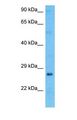 SPEF1 / C20orf28 Antibody - Western blot of SPEF1 Antibody with human Ovary Tumor lysate.  This image was taken for the unconjugated form of this product. Other forms have not been tested.