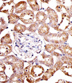 SPHK / SPHK1 Antibody - Immunohistochemical of paraffin-embedded M. kidney section using SPHK1 Antibody(N-term P74). Antibody was diluted at 1:100 dilution. A peroxidase-conjugated goat anti-rabbit IgG at 1:400 dilution was used as the secondary antibody, followed by DAB staining.