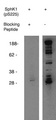 SPHK / SPHK1 Antibody - Western blot of anti-mouse SphK1 (pS225) (phospho-Sphingosine Kinase 1,(pS225), Mouse reactive) on mouse B-cell lysate. Antibody used at 1 ug/ml with phosphorylated blocking peptideNo. X1877B) (lane A) and without (lane B). 