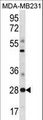 SPIB Antibody - SPIB Antibody western blot of MDA-MB231 cell line lysates (35 ug/lane). The SPIB antibody detected the SPIB protein (arrow).