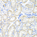 SPICE1 / CCDC52 Antibody - Immunohistochemistry of paraffin-embedded mouse kidney tissue.