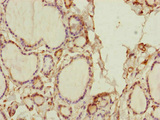 SPICE1 / CCDC52 Antibody - Immunohistochemistry of paraffin-embedded human thyroid tissue at dilution of 1:100