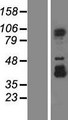 SPICE1 / CCDC52 Protein - Western validation with an anti-DDK antibody * L: Control HEK293 lysate R: Over-expression lysate