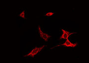 SPINK5 / LEKTI Antibody - Staining NIH-3T3 cells by IF/ICC. The samples were fixed with PFA and permeabilized in 0.1% Triton X-100, then blocked in 10% serum for 45 min at 25°C. The primary antibody was diluted at 1:200 and incubated with the sample for 1 hour at 37°C. An Alexa Fluor 594 conjugated goat anti-rabbit IgG (H+L) antibody, diluted at 1/600, was used as secondary antibody.