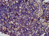 SPINK6 Antibody - Immunohistochemistry image at a dilution of 1:400 and staining in paraffin-embedded human tonsil tissue performed on a Leica BondTM system. After dewaxing and hydration, antigen retrieval was mediated by high pressure in a citrate buffer (pH 6.0) . Section was blocked with 10% normal goat serum 30min at RT. Then primary antibody (1% BSA) was incubated at 4 °C overnight. The primary is detected by a biotinylated secondary antibody and visualized using an HRP conjugated SP system.