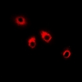 SPINLW1 / EPPIN Antibody - Immunofluorescent analysis of Eppin staining in HepG2 cells. Formalin-fixed cells were permeabilized with 0.1% Triton X-100 in TBS for 5-10 minutes and blocked with 3% BSA-PBS for 30 minutes at room temperature. Cells were probed with the primary antibody in 3% BSA-PBS and incubated overnight at 4 deg C in a humidified chamber. Cells were washed with PBST and incubated with a DyLight 594-conjugated secondary antibody (red) in PBS at room temperature in the dark.