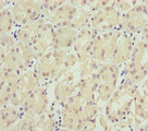 SPINLW1 / EPPIN Antibody - Immunohistochemistry of paraffin-embedded human gastric cancer at dilution of 1:100