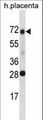 SPINT1 / HAI-1 Antibody - SPINT1 Antibody western blot of human placenta tissue lysates (35 ug/lane). The SPINT1 antibody detected the SPINT1 protein (arrow).