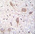 SPON1 / F-Spondin Antibody - VSGP/F-spondin Antibody immunohistochemistry of formalin-fixed and paraffin-embedded human brain tissue followed by peroxidase-conjugated secondary antibody and DAB staining.This data demonstrates the use of VSGP/F-spondin Antibody for immunohistochemistry.