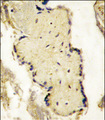 SPPL2A / IMP3 Antibody - Formalin-fixed and paraffin-embedded placenta tissue reacted with SPPL2a Antibody , which was peroxidase-conjugated to the secondary antibody, followed by DAB staining. This data demonstrates the use of this antibody for immunohistochemistry; clinical relevance has not been evaluated.