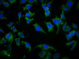 SPPL2B Antibody - Immunofluorescence staining of A549 cells diluted at 1:133, counter-stained with DAPI. The cells were fixed in 4% formaldehyde, permeabilized using 0.2% Triton X-100 and blocked in 10% normal Goat Serum. The cells were then incubated with the antibody overnight at 4°C.The Secondary antibody was Alexa Fluor 488-congugated AffiniPure Goat Anti-Rabbit IgG (H+L).