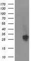 SPR Antibody - HEK293T cells were transfected with the pCMV6-ENTRY control (Left lane) or pCMV6-ENTRY SPR (Right lane) cDNA for 48 hrs and lysed. Equivalent amounts of cell lysates (5 ug per lane) were separated by SDS-PAGE and immunoblotted with anti-SPR.