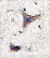 SPRED1 Antibody - Formalin-fixed and paraffin-embedded human brain tissue reacted with SPRED1 antibody , which was peroxidase-conjugated to the secondary antibody, followed by DAB staining. This data demonstrates the use of this antibody for immunohistochemistry; clinical relevance has not been evaluated.