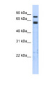 SPRING / TRIM9 Antibody - TRIM9 antibody Western blot of Transfected 293T cell lysate. This image was taken for the unconjugated form of this product. Other forms have not been tested.