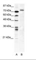 SPRING / TRIM9 Antibody - A: Marker, B: HepG2 Cell Lysate.  This image was taken for the unconjugated form of this product. Other forms have not been tested.