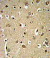 Sprouty 4 / SPRY4 Antibody - SPRY4-Y75 Antibody IHC of formalin-fixed and paraffin-embedded brain tissue followed by peroxidase-conjugated secondary antibody and DAB staining.