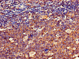 SPRR1A Antibody - Immunohistochemistry of paraffin-embedded human tonsil tissue using SPRR1A Antibody at dilution of 1:100