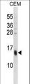 SPRR3 Antibody - SPRR3 Antibody western blot of CEM cell line lysates (35 ug/lane). The SPRR3 antibody detected the SPRR3 protein (arrow).