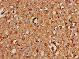 SPRY2 / Sprouty 2 Antibody - Immunohistochemistry of paraffin-embedded human brain tissue using SPRY2 Antibody at dilution of 1:100