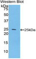 SPRY3 / Sprouty 3 Antibody - Western blot of recombinant SPRY3 / Sprouty 3.  This image was taken for the unconjugated form of this product. Other forms have not been tested.