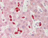 SPSB3 Antibody - Human Liver: Formalin-Fixed, Paraffin-Embedded (FFPE).  This image was taken for the unconjugated form of this product. Other forms have not been tested.