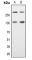 SPTAN1 / Alpha Fodrin Antibody - Western blot analysis of Alpha Fodrin expression in A549 (A); HeLa (B) whole cell lysates.
