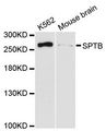 SPTB / Beta Spectrin Antibody - Western blot analysis of extracts of various cell lines, using SPTB antibody at 1:3000 dilution. The secondary antibody used was an HRP Goat Anti-Rabbit IgG (H+L) at 1:10000 dilution. Lysates were loaded 25ug per lane and 3% nonfat dry milk in TBST was used for blocking. An ECL Kit was used for detection and the exposure time was 90s.
