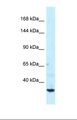 SPTBN1 / ELF Antibody - Western blot of Human NCI-H226. SPTBN1 antibody dilution 1.0 ug/ml.  This image was taken for the unconjugated form of this product. Other forms have not been tested.