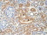 SPTLC1 / HSN1 Antibody - SPTLC1 antibody SPTLC1(serine palmitoyltransferase, long chain base subunit 1) Antibody was used in IHC to stain formalin-fixed, paraffin-embedded human kidney.  This image was taken for the unconjugated form of this product. Other forms have not been tested.