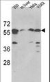 SPTLC1 / HSN1 Antibody - Western blot of hSPTLC1-S41 in 293, HeLa, K562 cell line and mouse liver tissue lysates (35 ug/lane). SPTLC1 (arrow) was detected using the purified antibody.