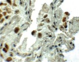 SPTLC1 / HSN1 Antibody - Immunohistochemistry of SPT1 in human lung tissue with SPT1 antibody at 5 ug/ml.