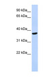 SPY1 / SPDYA Antibody - SPDYA antibody Western blot of Fetal Heart lysate. This image was taken for the unconjugated form of this product. Other forms have not been tested.