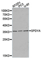 SPY1 / SPDYA Antibody - Western blot of extracts of various cell lines, using SPDYA antibody.