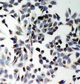 SQSTM1 Antibody - P62 / SQSTM1 antibody. ICC: HELA Cell.