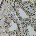 SR140 / U2SURP Antibody - Immunohistochemistry of paraffin-embedded human prostate tissue.