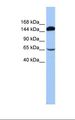 SRBD1 Antibody - 721_B cell lysate. Antibody concentration: 1.0 ug/ml. Gel concentration: 6%-18%.  This image was taken for the unconjugated form of this product. Other forms have not been tested.