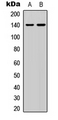 SRCIN1 / SNIP Antibody - Western blot analysis of p140 Cap expression in HEK293T (A); HeLa (B) whole cell lysates.