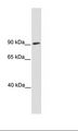 SREBF1 / SREBP-1 Antibody - SP2/0 Cell Lysate.  This image was taken for the unconjugated form of this product. Other forms have not been tested.