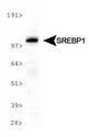 SREBF1 / SREBP-1 Antibody - SREBP1 Antibody (2A4) - Western blot of SREBP1 expression in HeLa lysate.  This image was taken for the unconjugated form of this product. Other forms have not been tested.