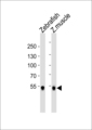 SREBF2 / SREBP2 Antibody - Western blot of lysates from Zebrafish and zebra fish muscle tissue lysate (from left to right) with (DANRE) srebf2 Antibody. Antibody was diluted at 1:1000 at each lane. A goat anti-rabbit IgG H&L (HRP) at 1:5000 dilution was used as the secondary antibody. Lysates at 35 ug per lane.
