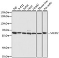 SREBF2 / SREBP2 Antibody - Western blot analysis of extracts of various cell lines, using SREBF2 antibody at 1:3000 dilution. The secondary antibody used was an HRP Goat Anti-Rabbit IgG (H+L) at 1:10000 dilution. Lysates were loaded 25ug per lane and 3% nonfat dry milk in TBST was used for blocking. An ECL Kit was used for detection and the exposure time was 90s.