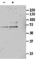 SRF / Serum Response Factor Antibody - SRF antibody (1 ug/ml) staining of untreated (first lane) and TGF-beta 1-treated (second lane) primary cultured Human Lung fibroblast lysate. Primary incubated overnight at 4C. Detected by Western blot of chemiluminescence.