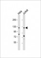 SRGAP3 Antibody - All lanes: Anti-SRGAP3 Antibody (C-term) at 1:2000 dilution. Lane 1: HeLa whole cell lysate. Lane 2: Jurkat whole cell lysate Lysates/proteins at 20 ug per lane. Secondary Goat Anti-Rabbit IgG, (H+L), Peroxidase conjugated at 1:10000 dilution. Predicted band size: 125 kDa. Blocking/Dilution buffer: 5% NFDM/TBST.