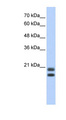 SRGN / Serglycin Antibody - SRGN antibody Western blot of Transfected 293T cell lysate. This image was taken for the unconjugated form of this product. Other forms have not been tested.