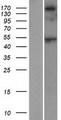 SRL / Sarcalumenin Protein - Western validation with an anti-DDK antibody * L: Control HEK293 lysate R: Over-expression lysate