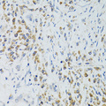 SRP19 Antibody - Immunohistochemistry of paraffin-embedded human colon carcinoma tissue.