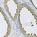 SRP19 Antibody - Immunohistochemical analysis of SRP19 staining in human prostate formalin fixed paraffin embedded tissue section. The section was pre-treated using heat mediated antigen retrieval with sodium citrate buffer (pH 6.0). The section was then incubated with the antibody at room temperature and detected using an HRP conjugated compact polymer system. DAB was used as the chromogen. The section was then counterstained with hematoxylin and mounted with DPX.