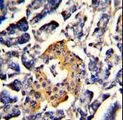 SRP72 Antibody - Formalin-fixed and paraffin-embedded human pancreas with SRP72 Antibody , which was peroxidase-conjugated to the secondary antibody, followed by DAB staining. This data demonstrates the use of this antibody for immunohistochemistry; clinical relevance has not been evaluated.