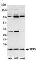 SRP9 Antibody - Detection of human SRP9 by western blot. Samples: Whole cell lysate (15 µg) from HeLa, HEK293T, and Jurkat cells prepared using NETN lysis buffer. Antibody: Affinity purified rabbit anti-SRP9 antibody used for WB at 0.1 µg/ml. Detection: Chemiluminescence with an exposure time of 3 minutes.