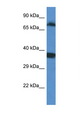 SRPK1 Antibody - SRPK1 antibody Western blot of Fetal Lung lysate. Antibody concentration 1 ug/ml.  This image was taken for the unconjugated form of this product. Other forms have not been tested.